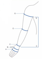 Shema točaka mjerenja kompresivnih rukava